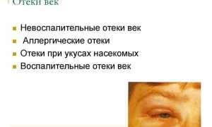 Отек нижнего века одного глаза у ребенка и болит – что делать в такой ситуации