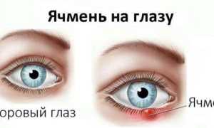 Что делать, если у ребенка вскочил ячмень на глазу: советы и рекомендации