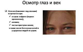 Отёкшие веки: причины и методы лечения для здоровья глаз