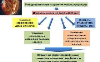 Фетоплацентарная недостаточность: почему возникает и как лечить, советы специалистов
