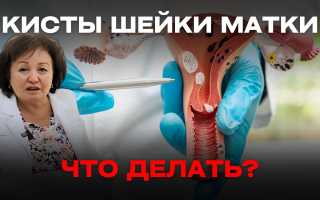 Киста в матке: способы лечения. Медицина и народные средства, рецепты, видео
