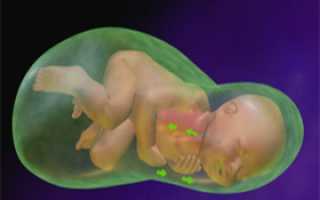 О чем говорят зеленые воды в родах и их значение