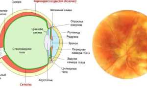 Хориоретинит глаза – причины возникновения и методы лечения, советы специалистов