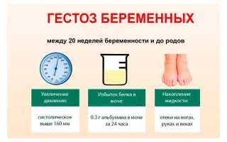 Лечение гестоза при беременности: важные аспекты и рекомендации