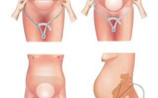 Наружное акушерское исследование: важные аспекты и рекомендации