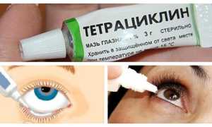 Глазная мазь Тетрациклин с инструкцией по применению и рекомендациями