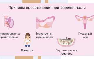 Маточное кровотечение: причины и последствия