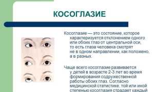 Офтальмологические болезни: как лечить косоглазие и сохранить зрение?