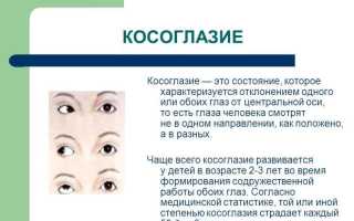 Офтальмологические болезни: как лечить косоглазие и сохранить зрение?