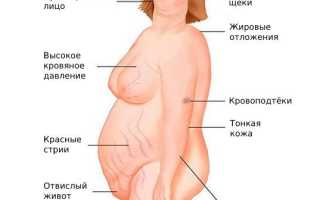 Гиперандрогения на ранних сроках беременности: причины и последствия