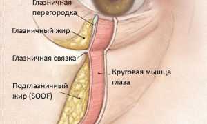 Как убрать грыжу под глазами и избавиться от мешков без операции навсегда
