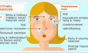 Красные глаза – аллергия: точки и пятна возле глаз у взрослых