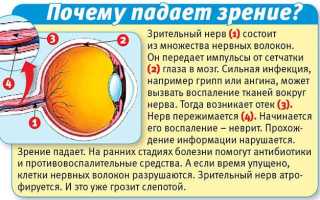 Что делать, если падает зрение: советы и рекомендации
