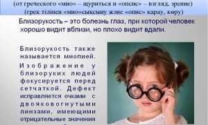Зрение минус: что это такое и как лечить проблемы со зрением