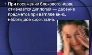Двоение в глазах – причины и лечение диплопии бинокулярной и монокулярной у взрослых
