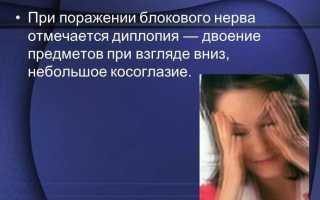 Двоение в глазах – причины и лечение диплопии бинокулярной и монокулярной у взрослых