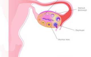 Мультифолликулярные яичники и беременность — возможно ли это в реальной практике