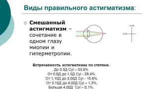 Смешанный астигматизм: причины развития и варианты лечения глазных заболеваний