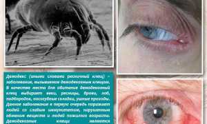 Под глазом красное пятно, шелушится – почему у ребенка вокруг глаз и что делать