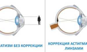 Очки подобрать для зрения – как правильно: линзы по рецепту или онлайн, советы специалистов