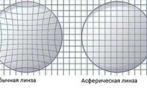 Специфика и преимущества контактной оптики – асферические линзы для комфортного ношения
