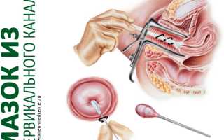 Что означает мазок на чувствительность к антибиотикам при беременности и его значение для здоровья