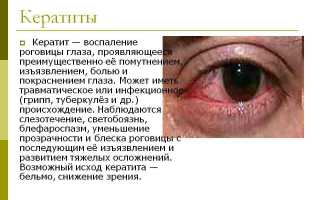 Вирусный кератит: причины, симптомы и способы лечения заболевания у людей