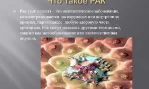 Опухоль глаза – симптомы онкологии глазного яблока и их последствия