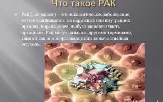 Опухоль глаза – симптомы онкологии глазного яблока и их последствия