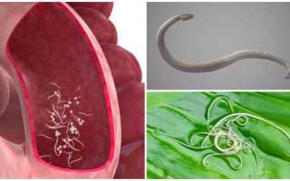 Гельминты при беременности: что нужно знать