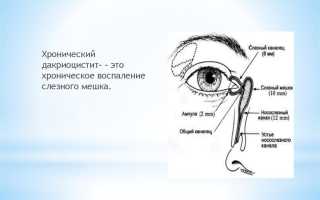 Дакриоцистит: причины развития и методы лечения у детей