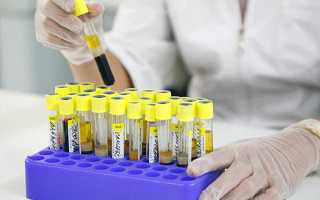 Анализ кала при беременности: как правильно сдать и что учитывать