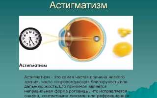 Контактные линзы при астигматизме: особенности и рекомендации