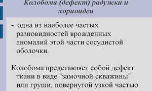 Колобома: описание заболевания, причины и лечение, а также рекомендации