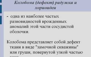 Колобома: описание заболевания, причины и лечение, а также рекомендации