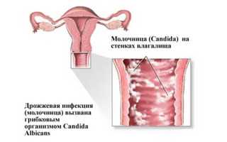 Можно ли сдавать мазок на флору при молочнице
