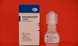 Ксалатан – капли для глаз: инструкция по применению и рекомендации
