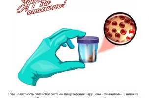 Анализ кала на скрытую кровь при беременности: важные аспекты и рекомендации