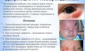Закупорка слезного канала у новорожденных – массаж: как делать при дакриоцистите правильно и эффективно