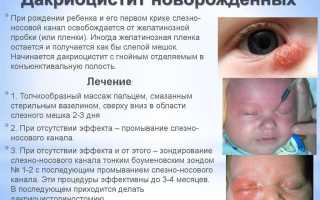 Закупорка слезного канала у новорожденных – массаж: как делать при дакриоцистите правильно и эффективно