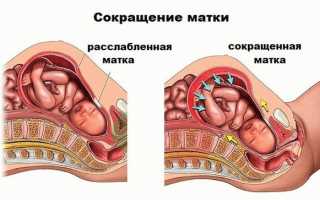 Чем опасен тонус матки, симптомы и последствия