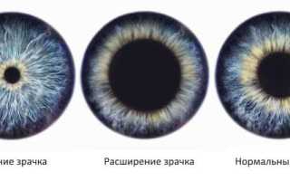 Причины суженных зрачков (миоза), виды, методы лечения и профилактика