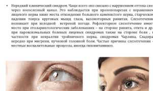 От слезотечения глазные капли – от слезоточивости для глаз, если слезятся, полезные советы