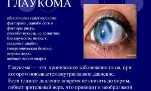 Врожденная форма глаукомы: симптоматика и лечение у детей
