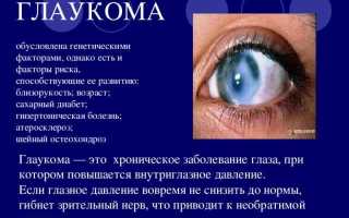 Врожденная форма глаукомы: симптоматика и лечение у детей