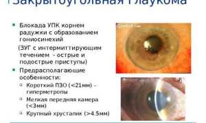 Закрытоугольная глаукома: причины и способы лечения заболевания