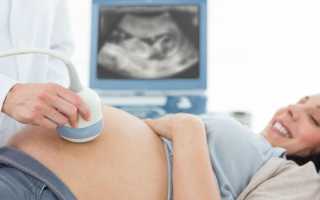 Что такое допплерография плода при беременности и её значение