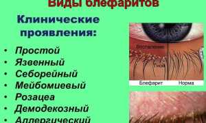 Воспаление на веке глаза – что делать, как и чем лечить, если покраснело и опухло, советы специалистов