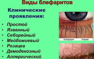 Воспаление на веке глаза – что делать, как и чем лечить, если покраснело и опухло, советы специалистов