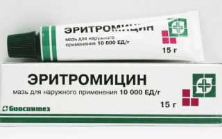 Эритромициновая глазная мазь – все про препарат и его применение